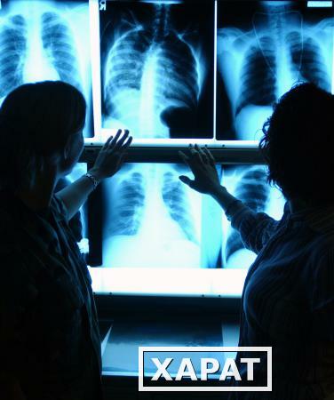 Фото Рентгенография органов грудной полости (3 проекции)