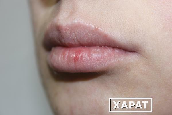 Фото Перманентный макияж губ