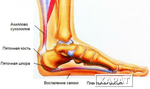 Фото Рентгенография пяточной кости (2 проекции)