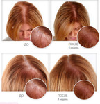 Фото №5 Спрей Ultra Hair System для восстановления волос