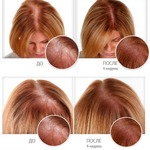 Фото №2 Спрей Ultra Hair System для роста волос