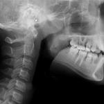 фото Рентгенография нижней челюсти ( 2 проекции)