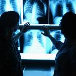 фото Рентгенография органов грудной полости (3 проекции)