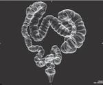 фото КТ-виртуальная колоноскопия без оценки паренхиматозных органов брюшной полости